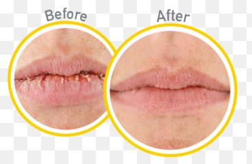 Ou0027keeffeu0027s Lip Repair Spf 35 Emoji,Sweet Emotions Soap Lip