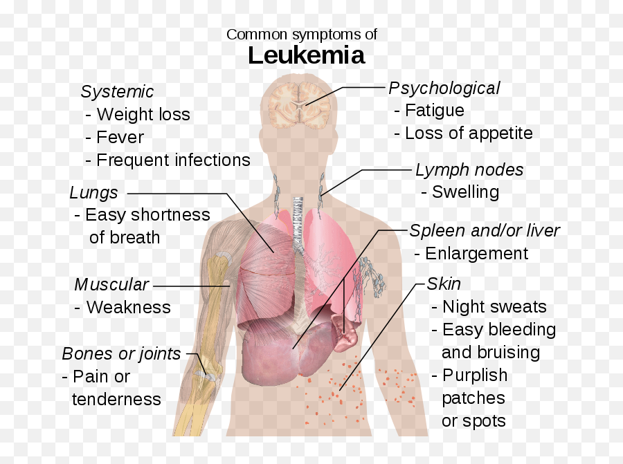 Krok Med Easy - Common Symptoms Of Leukemia Emoji,Repressed Female Emotion In Levator Scapulae