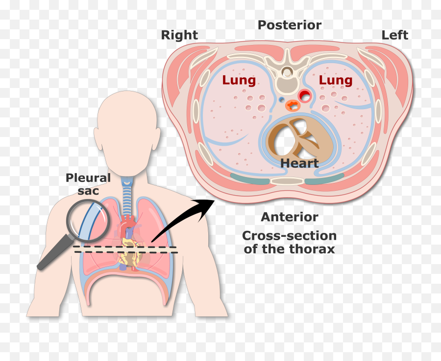 Pleura Or Pleurae And Pleural Cavity Of The Lungs Emoji,Visceral &/or Emotions