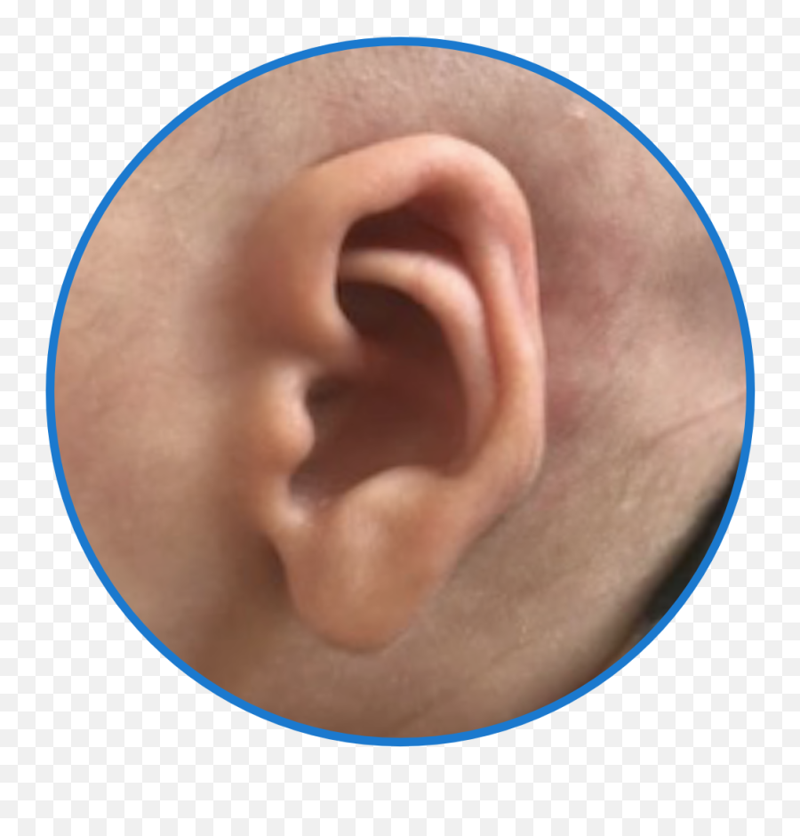 Ear Of The Month Award - Solid Emoji,Nekomimi Emotion Ears
