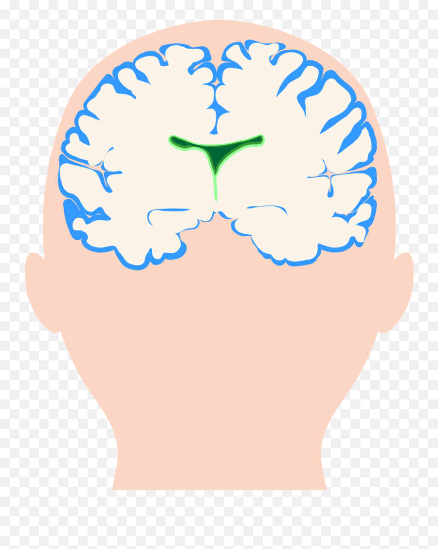 What Multiple Sclerosis Looks Like In Your Brain Everyday - For Adult Emoji,Fight With Your Head Not Your Emotions