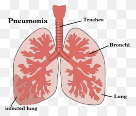 Ineffective Airway Clearance Care Plan - Aerobic And Anaerobic Respiration Emoji,Gastric Cancer Nursing Diagnosis Emotion