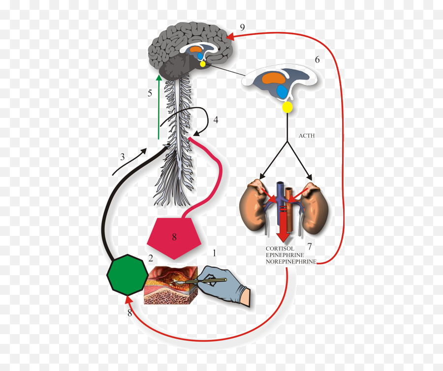 Agitation And Pain In The Recovery Room Tutorial Emoji,Somatovisceral Afference Model Of Emotion (same)