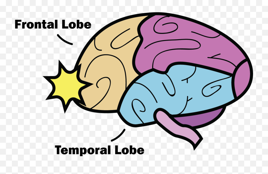 Clipart Brain Concussion - Frontal And Temporal Lobes Emoji,Temporal Lob Emotion