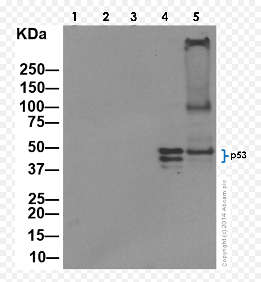 Recombinant Anti - Mutant P53 Antibody E47 Ab32509 Abcam P53 Antibody Emoji,Terminus Est Emojis