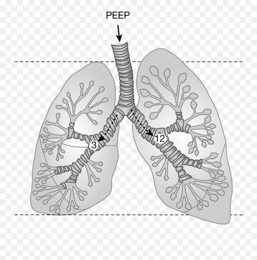 Pulmonary System - Sketch Emoji,Im In A Glass Cage Of Emotion