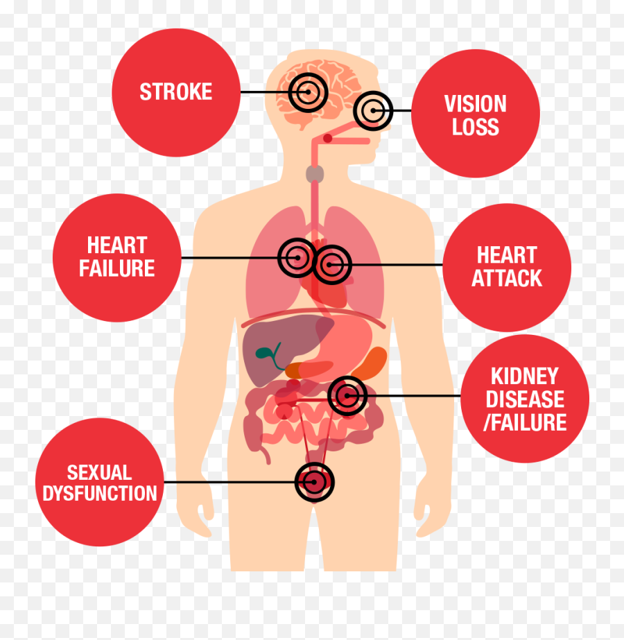 What Is Hypertension And Symptoms And Causes Of It - Health Risks Of High Blood Pressure Emoji,Nosebleed Emoji