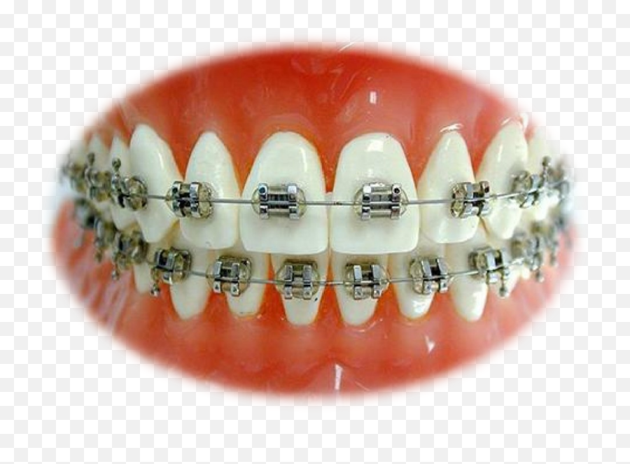 Teeth Smile Faketeeth Sticker By R Dayberry Emoji,Braces Smile Emoji
