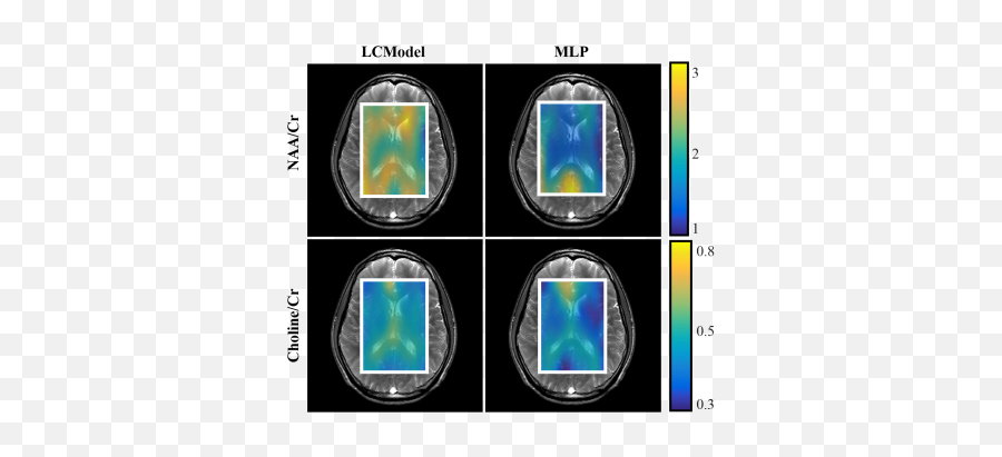 Joint Annual Meeting Ismrm - Esmrmb 2018 Vertical Emoji,Work Emotions Cr-kai