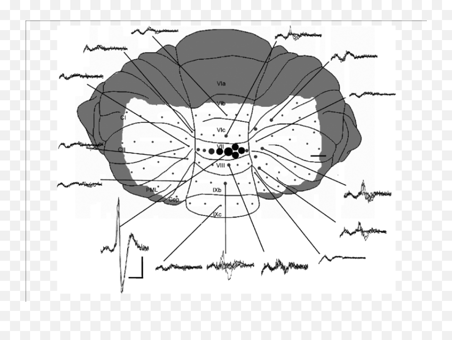 Mapping Of Cerebellar Fi Eld Potentials - Dot Emoji,Medial Dorsal Nucleus Thalamus Memory Emotion Step 1